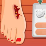 صورة Foot Surgery